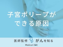 「子宮ポリープができる原因」とは？症状や放置した場合も医師が解説！