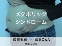 「メタボリックシンドローム」の診断基準・予防法はご存知ですか？医師が監修！