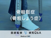 「骨粗鬆症（骨粗しょう症）」の初期症状・予防法はご存知ですか？医師が監修！
