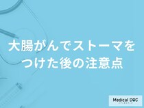 「大腸がんでストーマをつけた後の5つの注意点」はご存知ですか？【医師解説】