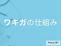 両親がワキガだと「子どもも高確率で発症」するのは本当？【医師解説】
