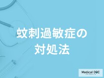 「蚊刺過敏症の対処法」はご存知ですか？医師が監修！