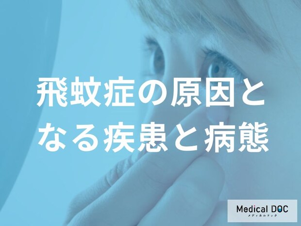 「飛蚊症」の原因として注意すべき疾患をご存じですか？ 視力低下の可能性を医師が解説