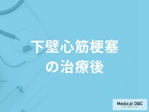 「下壁心筋梗塞は再発」するのか？治療後について医師が解説！