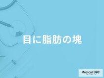 「目に脂肪の塊」はがんの可能性も？考えられる病気を医師が徹底解説！