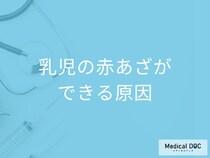 「乳児の赤あざ」ができる原因はご存じですか? あざの種類と特徴を医師が解説!