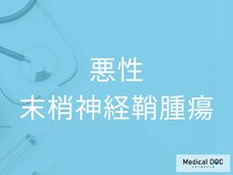 「悪性末梢神経鞘腫瘍」になりやすい人の特徴をご存じですか？ 予防法を併せて医師が解説
