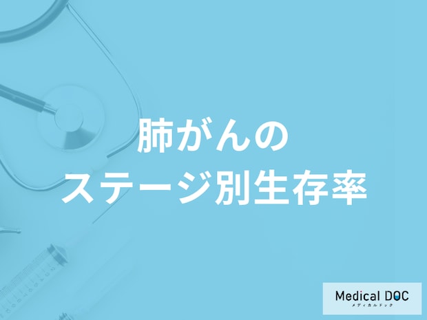 「肺がんのステージ別生存率」はご存じですか?肺がんの症状も医師が解説!