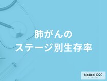 「肺がんのステージ別生存率」はご存じですか？肺がんの症状も医師が解説！