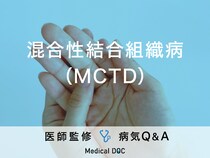 「混合性結合組織病（MCTD）」とは？症状や原因について医師が解説！