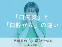 「口内炎」と「口腔がん」の違いはご存知ですか？医師が監修！