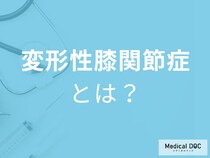 【40代から急増】“変形性膝関節症”になりやすい人の特徴を医師解説