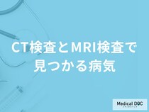「CT検査とMRI検査で再検査・要精密検査」と診断されたらどうしたらいい？医師が解説！