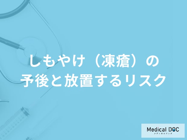 「しもやけ（凍瘡）」が重症化する現れる症状とは？予後も医師が解説！