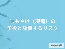 「しもやけ（凍瘡）」が重症化する現れる症状とは？予後も医師が解説！