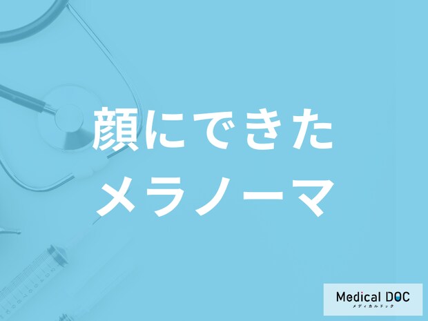 「顔にできたメラノーマ」とほくろとの見分け方はご存知ですか？医師が解説！