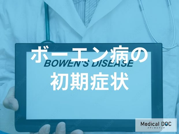 「ボーエン病」を発症すると皮膚がどう変化する？初期症状を解説!【医師監修】