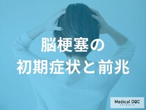 「脳梗塞の前兆」はご存知ですか? 初期症状のセルフチェックで後遺症を防ぐ【医師監修】