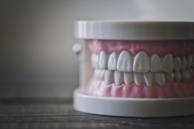 抜歯矯正で口元が下がりすぎた場合の影響