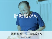 「肝細胞がん」になると現れる症状や原因はご存知ですか？ステージについても解説！