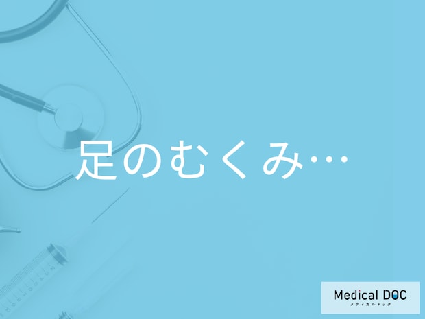 靴下の跡がくっきり… 高齢者の「足のむくみ」 原因となる病気や薬、生活習慣とは?