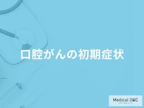 「口腔がんの初期症状」はご存知ですか？医師が監修！