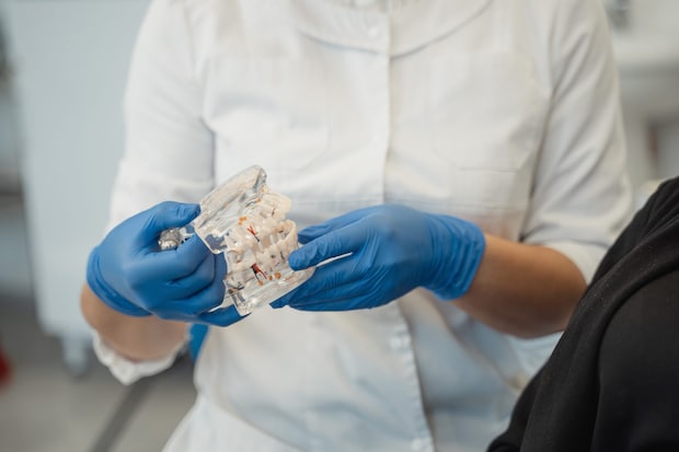 オールオン4治療後に歯茎に隙間ができる原因