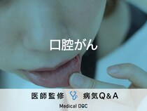 「口腔がん」の初期症状はご存知ですか？医師が監修！