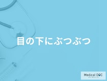 「目の下にぶつぶつ」ができる原因はご存じですか？考えられる病気も医師が徹底解説