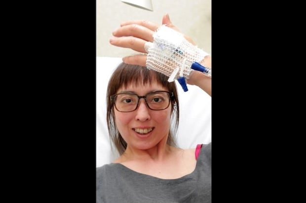 【闘病】「シェーグレン症候群」に続く難病は『皮膚筋炎』だった… 筋力落ち、体動かず