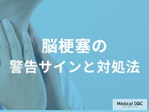 「脳梗塞」は時間との勝負! 見逃してはいけない警告サインと対処法【医師解説】