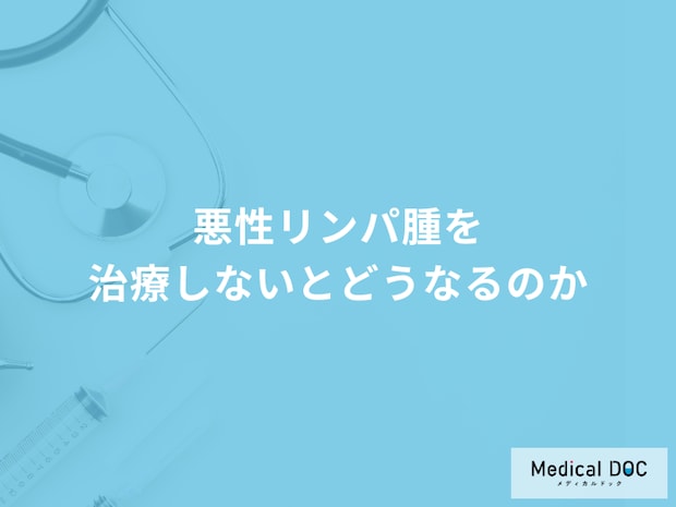 「悪性リンパ腫を治療しない」とどうなるかご存知ですか？医師が徹底解説！