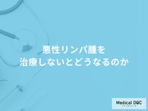 「悪性リンパ腫を治療しない」とどうなるかご存知ですか？医師が徹底解説！