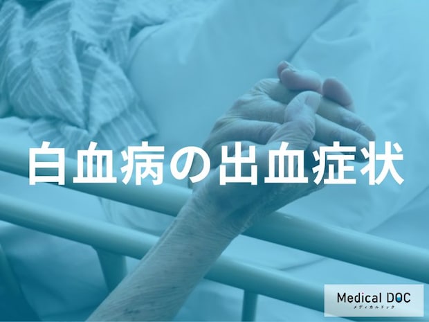 「ぶつけてないのにあざ」は要注意! 「白血病」が潜む皮膚のサインとは