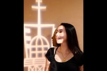 【闘病】片頭痛と思っていた痛みは｢脳動静脈奇形｣によるものだった