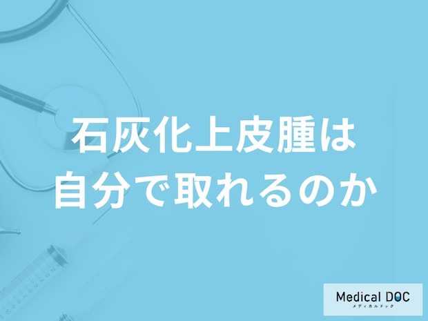 「石灰化上皮腫」は自分で取ることは可能なのか？再発についても医師が確認！