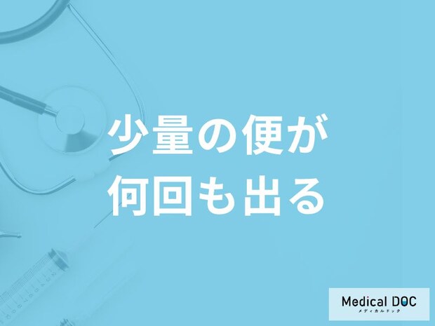 「少量の便が何回も出る」原因はご存知ですか？受診の目安となるセルフチェック法も解説！