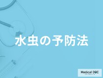 「水虫の前兆症状」は何かご存じですか？予防法も医師が解説！