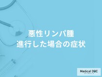 「悪性リンパ腫」が進行するとどんな症状が出るかご存知ですか？【医師解説】