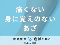 「痛くない身に覚えのないあざ」ができる原因はご存知ですか？医師が徹底解説！