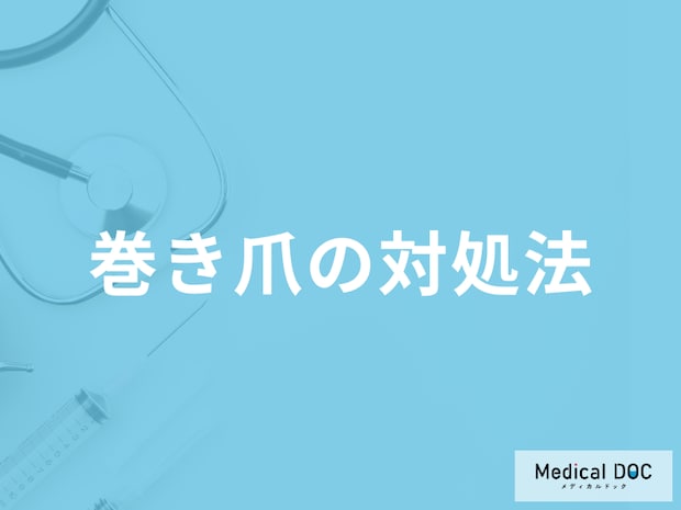 「巻き爪を爪切りで切るときの注意点」はご存知ですか？予防法も医師が解説！