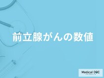 「前立腺がん」を発症すると検査でどんな「数値結果」が出るかご存知ですか？【医師解説】