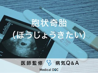 「胞状奇胎」になりやすい人の特徴はご存知ですか？医師が監修！