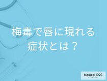 「梅毒」に感染すると「唇」にどんな症状が現れる？進行すると唇はどうなるかも解説！