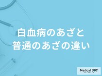 「白血病のあざと普通のあざの違い」はご存知ですか？白血病であざができる原因も解説！