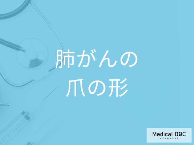「爪の形」がどのように変化したら「肺がん」を疑った方がいい？3つの特徴を医師が解説！