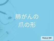 「爪の形」がどのように変化したら「肺がん」を疑った方がいい？3つの特徴を医師が解説！