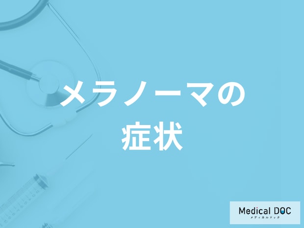「メラノーマの症状」はご存知ですか？転移しやすい部位も解説！【医師監修】