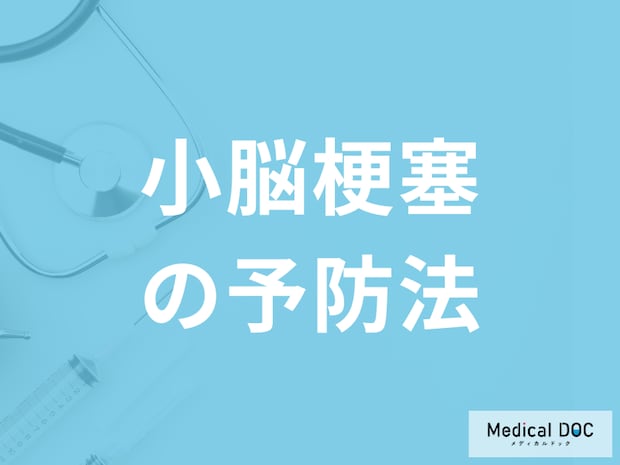 「小脳梗塞の予防法」は何を注意すれば良いのかご存知ですか？医師が徹底解説！