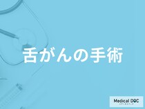 「舌がんの手術方法」は何をするのかご存じですか？手術以外の治療法も医師が解説！